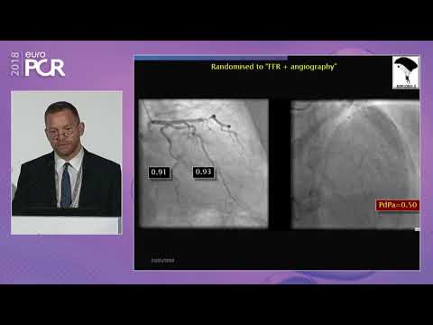 COMET: advancing the use of physiology in PCI, from routine to complex cases