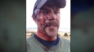 Man takes grizzly attack selfie