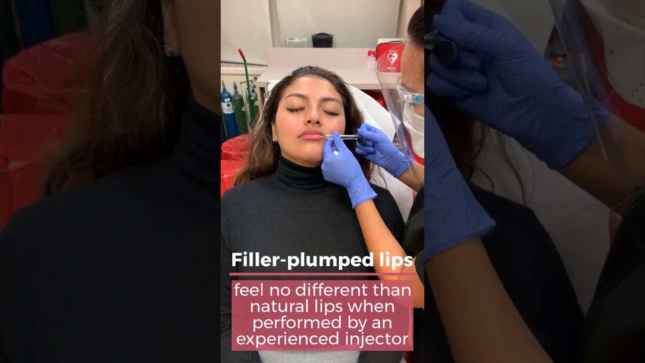 Lip Filler