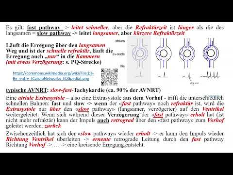 Herzrhythmusstörungen - Paroxysmale supraventrikuläre Tachykardien 1: AVNRT