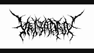 【Veiyadra】 Putrid Infection→Sanguineous Mortuary　(Brutal Death Metal)