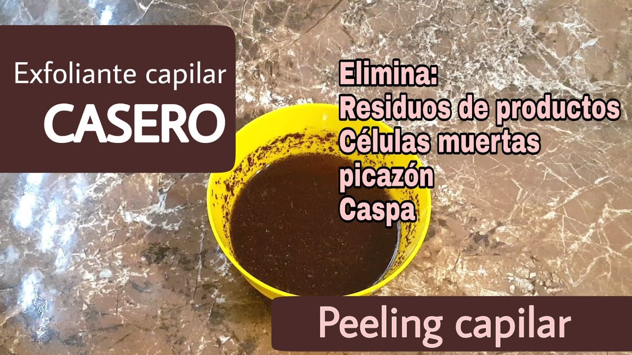 Cómo ELIMINAR LA CASPA y picores en el cuero cabelludo, EXFOLIANTE CAPILAR (peeling) |Afro Mery 🌸
