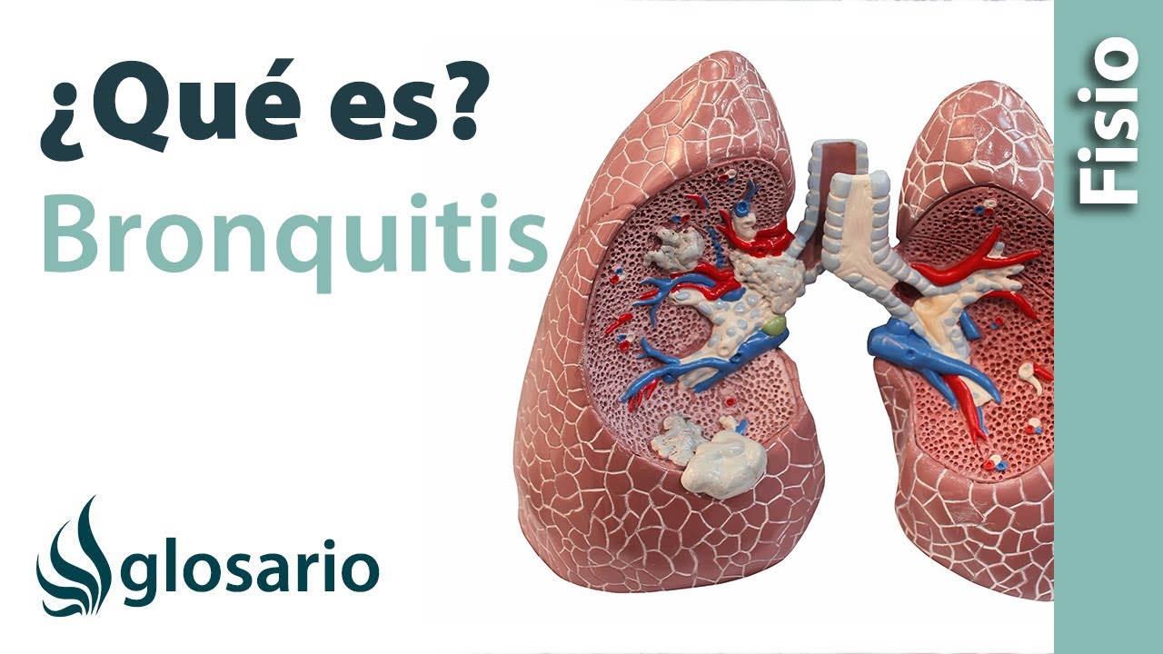 BRONQUITIS | Qué es, qué estructuras afecta, síntomas, signos, causas y tratamiento fisioterapéutico