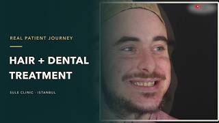Daniel’s Hair Transplant & Dental Treatment Experience | UK to Istanbu