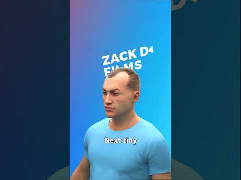 How Hair Transplants Work 🤔