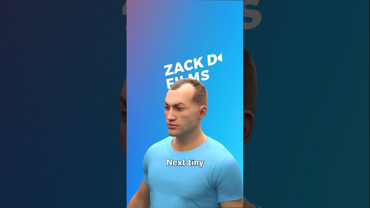 How Hair Transplants Work 🤔