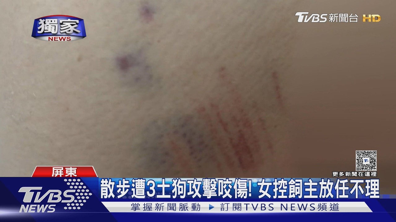 獨家影音/散步遭3土狗攻擊! 女大腿遭撕咬 飼主冷回:你叫太大聲