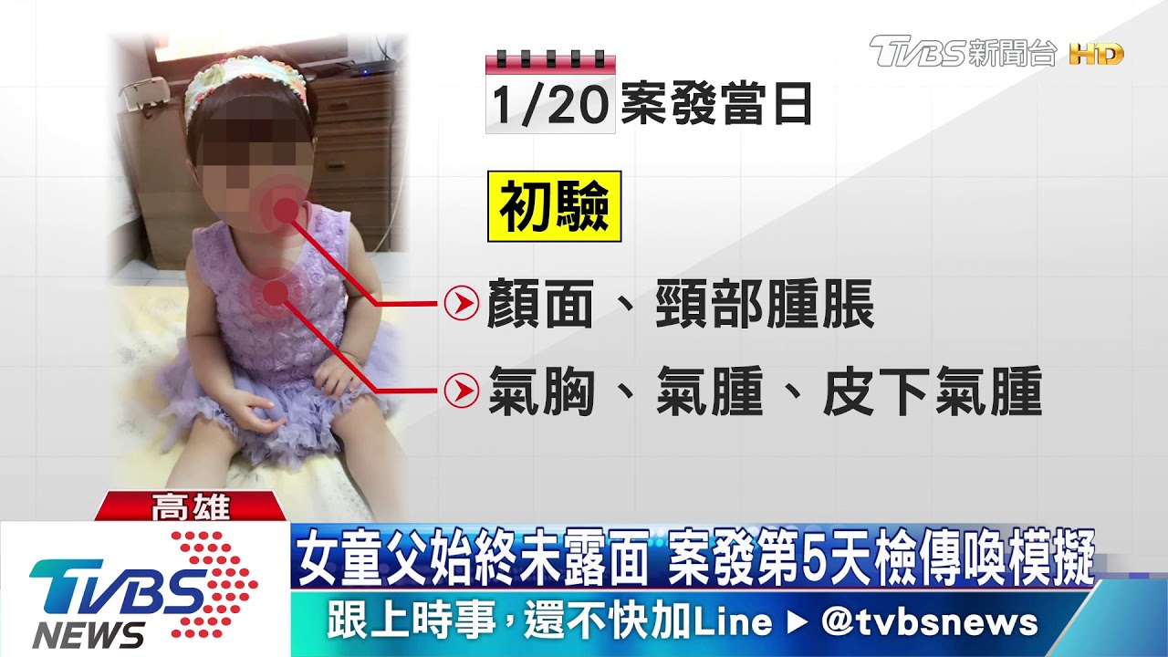 噴槍女童死於「氣體栓塞」 母:盼檢察官釐真相