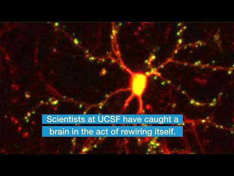 Scientists Catch Brain Circuits in the Act of Rewiring