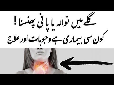 Dysphagia Difficulty In Swallowing Urdu Hindi - Gale Mein Khana Atakna
