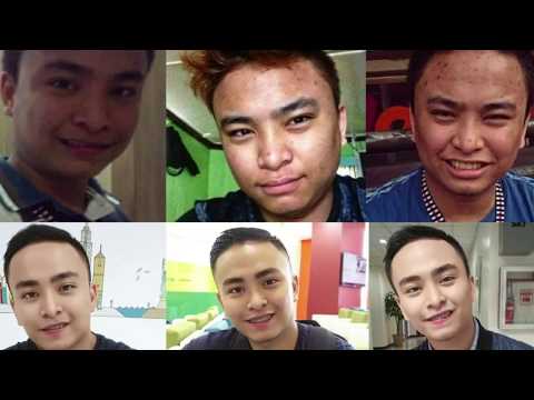 Kung paano alisin ang taba at cellulite sa binti Kung paano alisin ang taba sa lacquered kasangkapan sa bahay