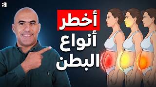أخطر 3 أنواع للكرش | اكتشف نوع بطنك وتخلص من دهون البطن بسرعة 🔥
