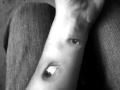 The Itch I Can T Scratch