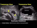 Pancreas Ultrasound Reporting | Diseases Scan Reports | How To Write USG Report | Abdominal USG