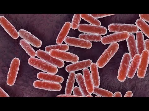 WHO seeks answers and clarity over plague lab death in Russia