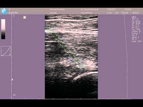 Giunti di endoscopia nei cani Trattamento di hip coxartrosi a Mosca