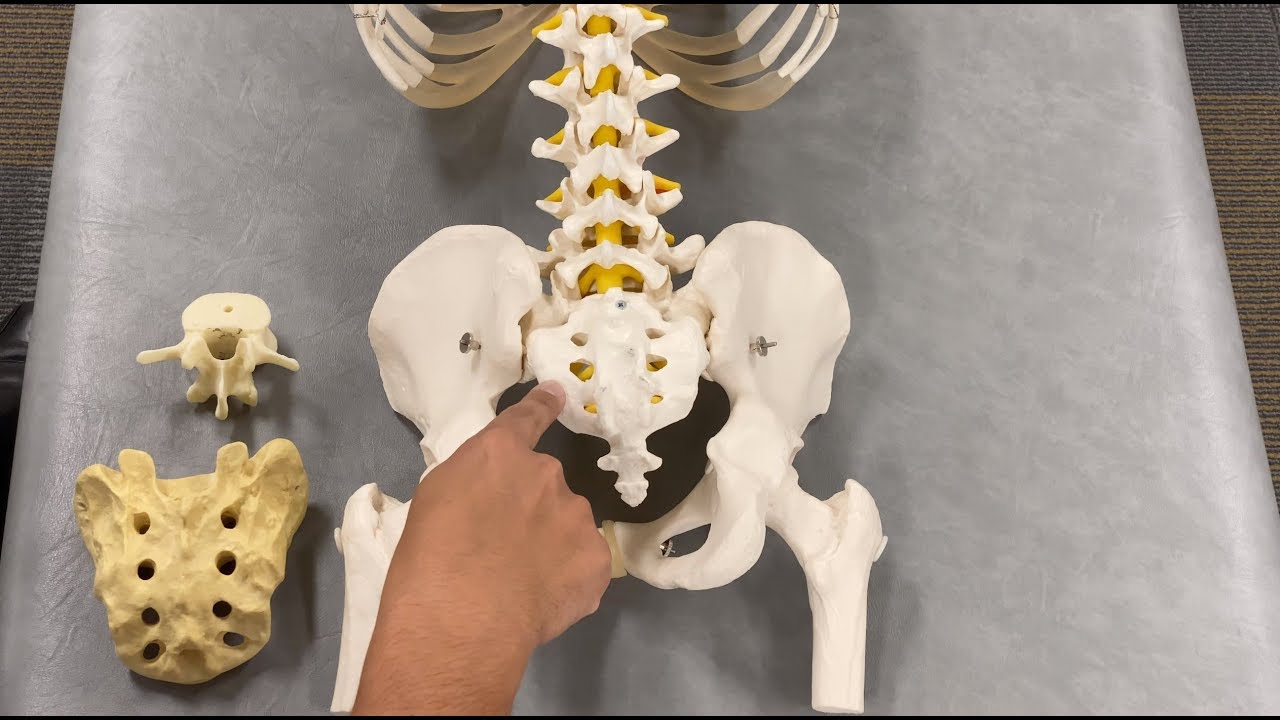 OMT: Somatic Dysfunction Sacrum Part 1