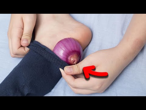 , title : 'Put an onion in your sock before sleeping and witness a miracle'