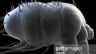 How to Get Rid Of Scabies/Skin Mites