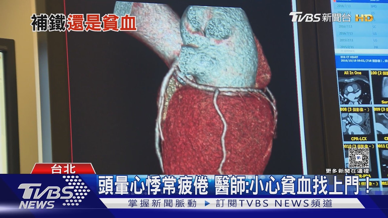 頭暈 沒力 心跳快「貧血警訊」? 醫揭3大原因!補鐵前先檢查
