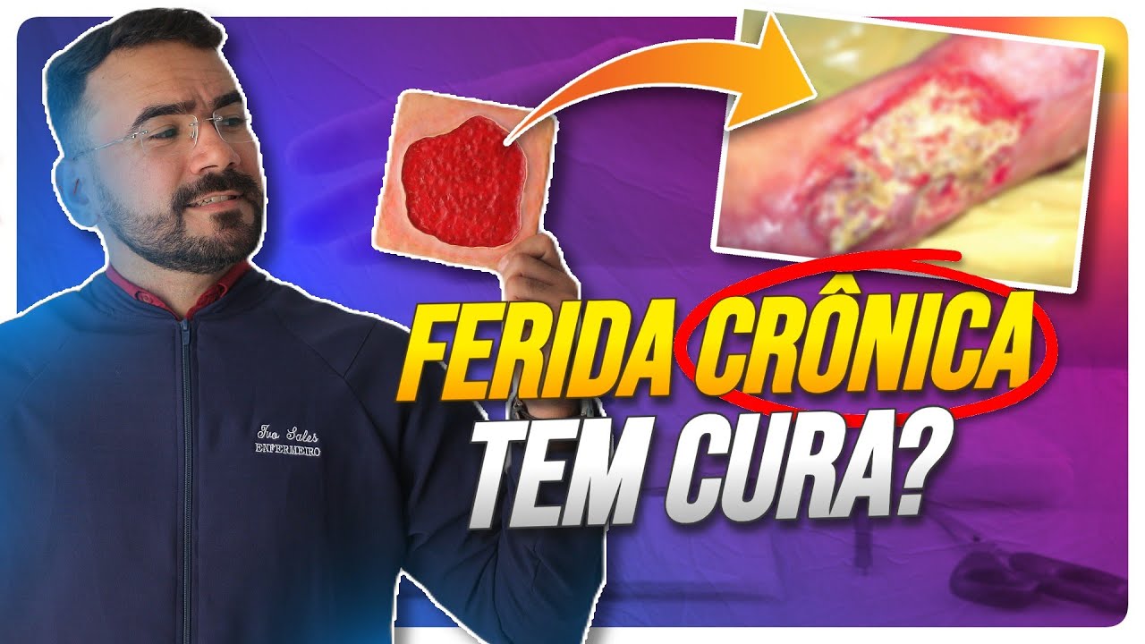 POR QUE A FERIDA CRÔNICA DEMORA TANTO PARA CICATRIZAR? (ENTENDA OS MOTIVOS)