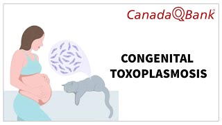 Congenital Toxoplasmosis: Causes, Symptoms, Diagnosis &amp; Treatment | CanadaQBank