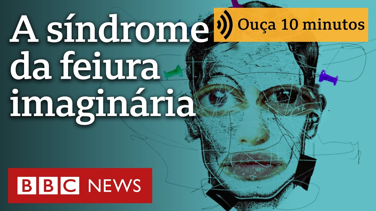 Dismorfia corporal: 'preocupação com meu aspecto físico não me deixava viver'