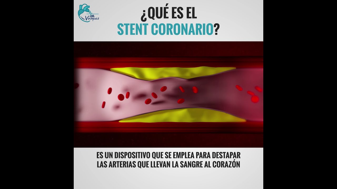 José Luis Vázquez Torres-26