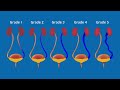 What is Vesicoureteral Reflux (VUR) - Animated Video