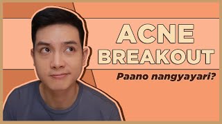 How to know the CAUSE of your BREAKOUT! (Filipino) | Jan Angelo