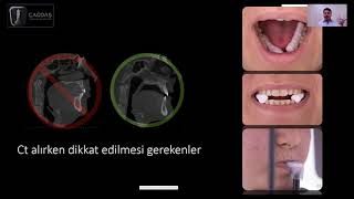 Cerrahi rehber (guide) üretimi için tomografi ve ölçü alırken nelere dikkat edil