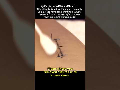 How to Remove Stitches (Sutures) Nursing Clinical Skill #shorts  #nursing #nurse