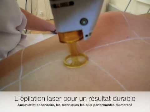 Centre Laser Murano Miniature vidéo YouTube 22