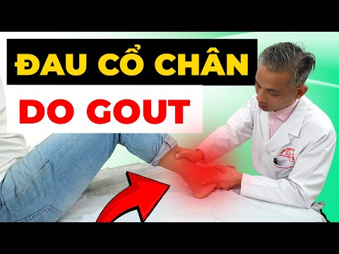 Đau Cổ Chân Dai Dẳng Không Khỏi? Có Thể Dấu Hiệu Gout Âm Thầm Phá Hủy Khớp