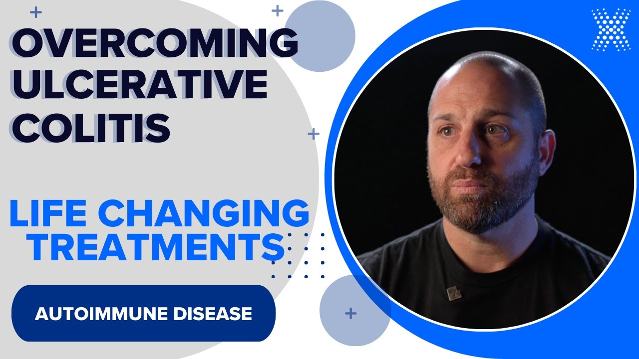 Overcoming Ulcerative Colitis Through Stem Cell Treatment