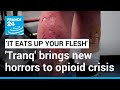 'It eats up your flesh': 'Tranq', the new drug worsening America's opioid epidemic • FRANCE 24