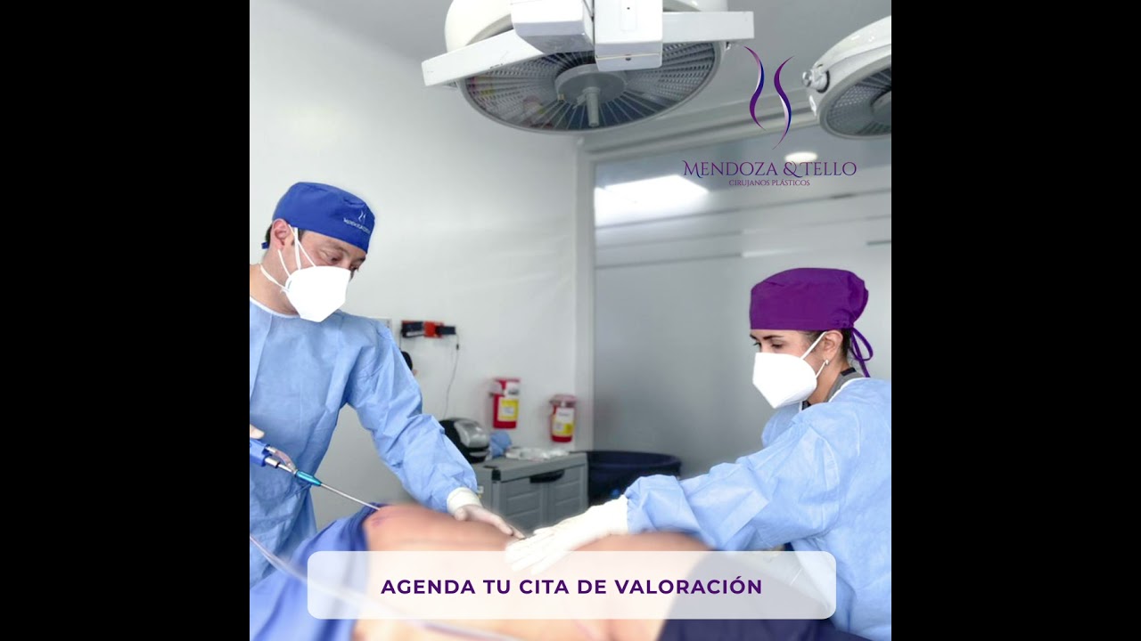 Alexander Mendoza-91