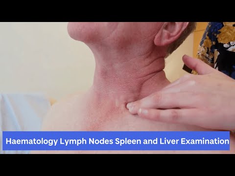 Haematology lymph nodes, Spleen and Liver Examination