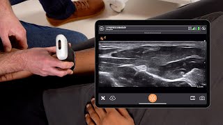 Scanning the Median Nerve