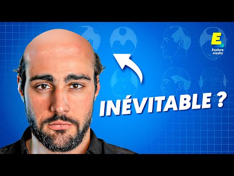 Pourquoi les hommes perdent leurs cheveux ?