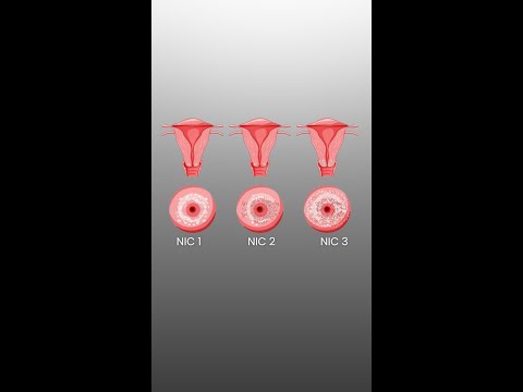O que é NIC 1, 2 e 3? Entenda de forma simples!
