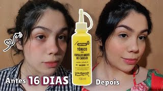 16 dias usando o Tônico de Alho da Gota Dourada | Crescimento e fortalecimento capilar😱❤