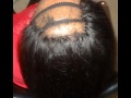 Hide Alopecia or Hair Loss w/ a Crochet Weave ...