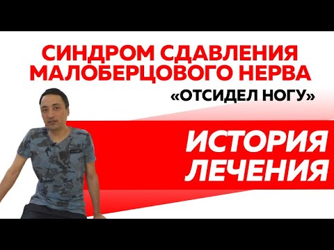 Парез стопы. Онемение и неподвижность стопы. Отсидел ногу. Сдавление нерва.