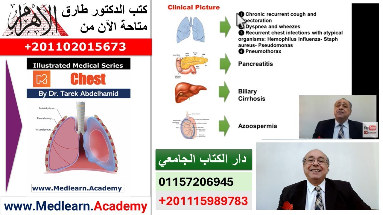 Cystic Fibrosis   #cme #internal_medicine #medical #usmle #محاضرات_باطنة