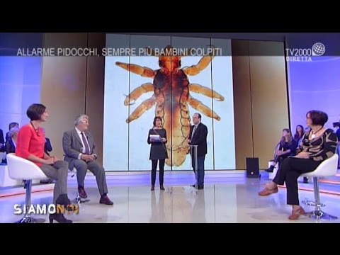 I segni che ha parassiti in un organismo Come trattare vermi a bambini in 8