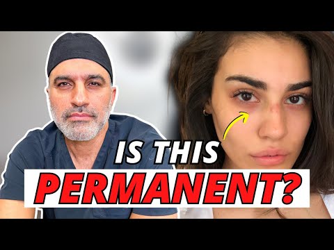 Transform Your Undereyes: Why you have dark circles and what to do about it!