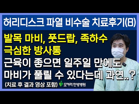 치료후기사진 입니다.