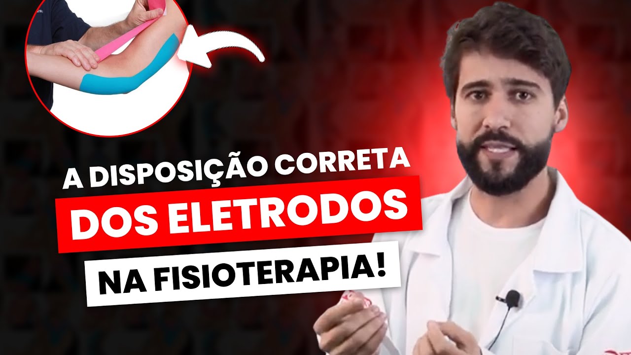 Saiba a disposição correta dos ELETRODOS na FISIOTERAPIA!