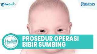 Mengenal Prosedur Penatalaksanaan Bibir Sumbing, Satu di Antaranya Memperbaiki Celah pada Gusi